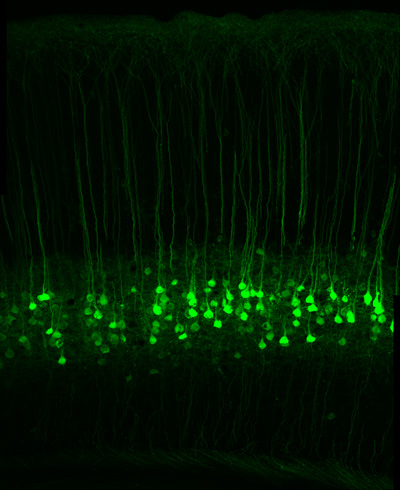 pyramidal cells in the mouse brain