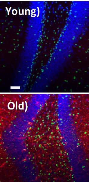 old brain tissue is flooded with TGF-beta1