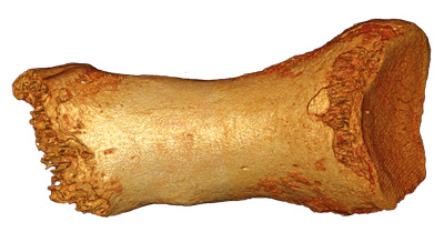 toe bone of a Neanderthal woman