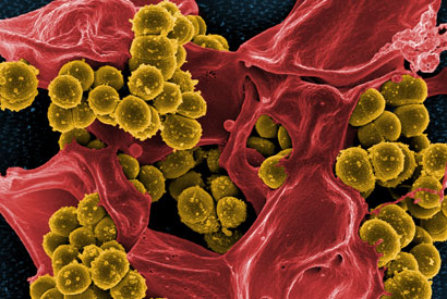 Staph bacteria