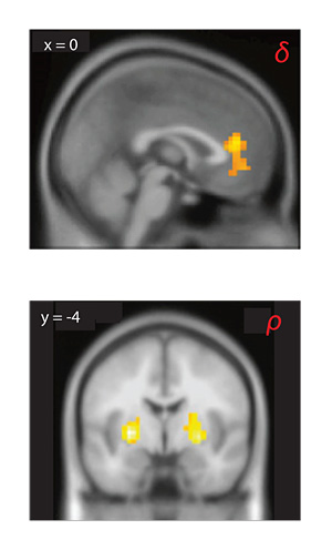 brain scans of people playing betting games