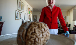 A photo of a human brain in close perspective with an elderly woman standing behind it. 