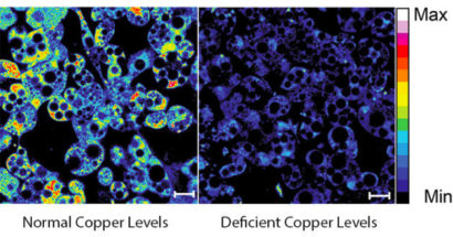 copper in fat cells