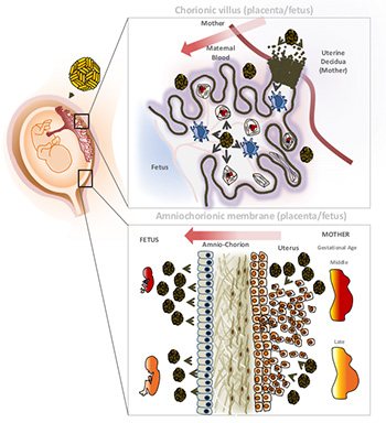 two modes of Zika virus fetal infection