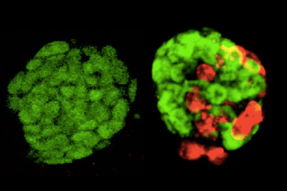 normal and totipotent-like ES cells