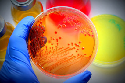 petri dish