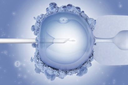 IVF