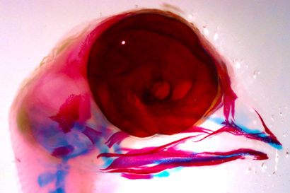 Chick embryos stained blue and red to identify craniofacial features.
