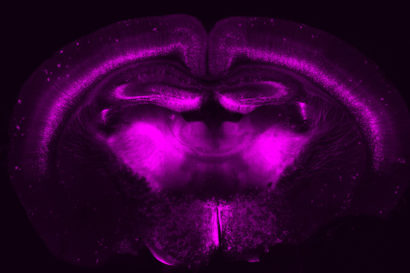 labeled neurons in mouse brain