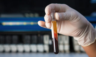 blood in test tube
