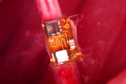 StimDust cuffed to a nerve