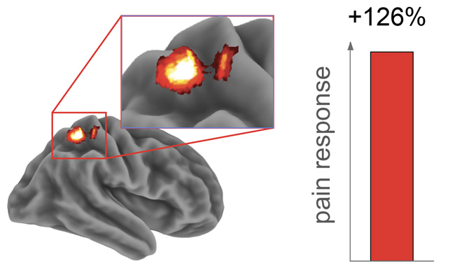 Graphic of activity in the somatosensory cortex after a sleepless night.