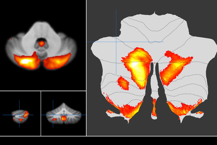 red and orange colored images of the brain's cerebellum