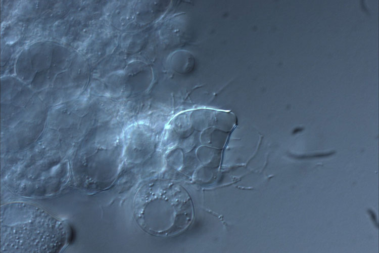A microscope image of the chytrid fungus
