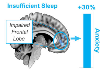 A graphic showing how a sleepless night can boost anxiety levels up to 30 percent.