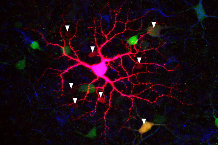 light-sensitive cell in mouse retina