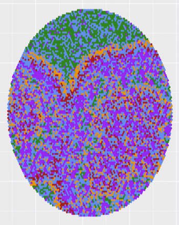 a model showing cells being taken over by a viral infection