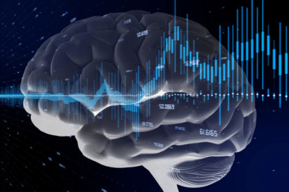 brain illustration with noise waves superimposed