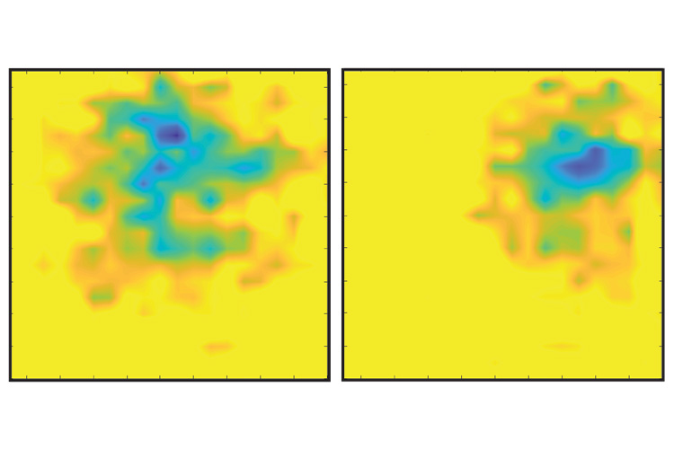 turquoise on yellow background represents electric field changes of beating heart