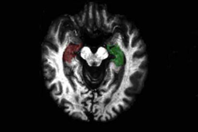 black and white images of brain
