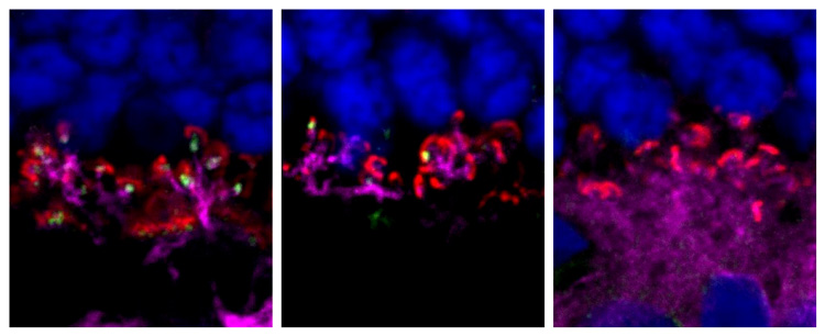 cells in the retina labeled with blue and red