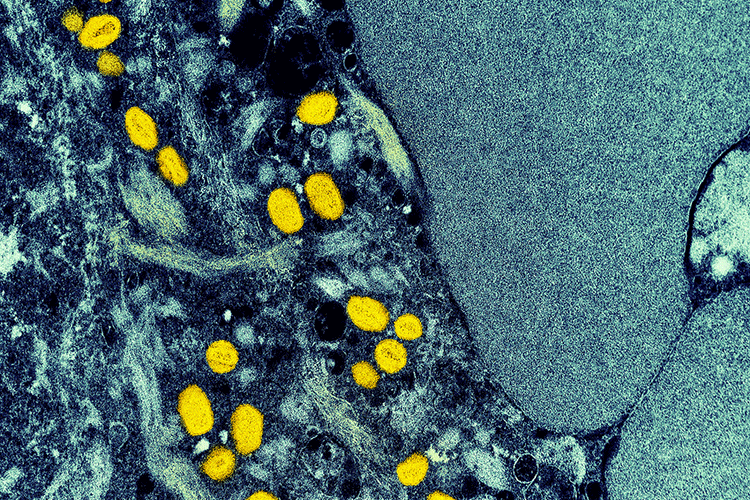 A microscope images shows small monkeypox virus particles in yellow, embedded within blue-tinted cellular tissue.