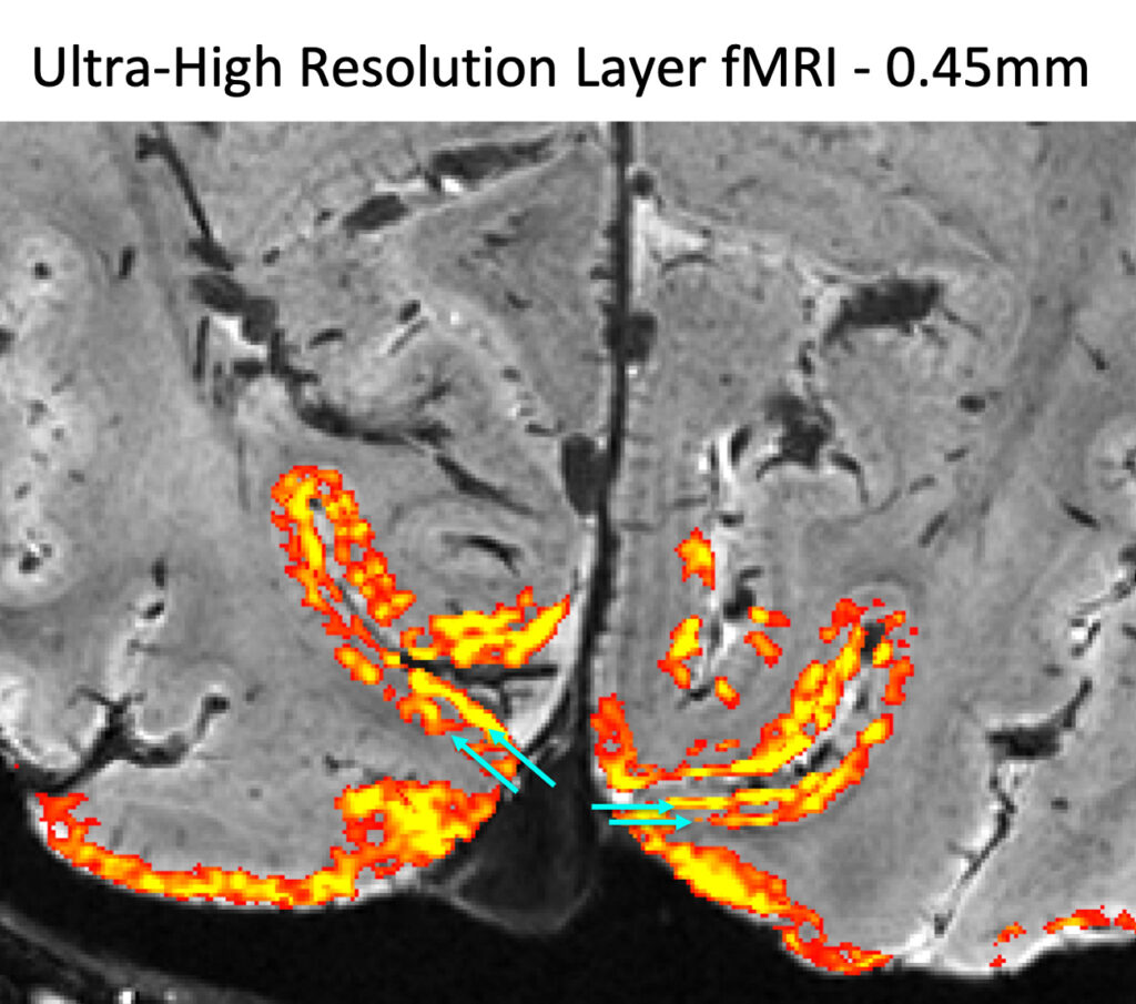 gray and black slice through brain, with blue arrows showing layers highlighted in yellow and orange