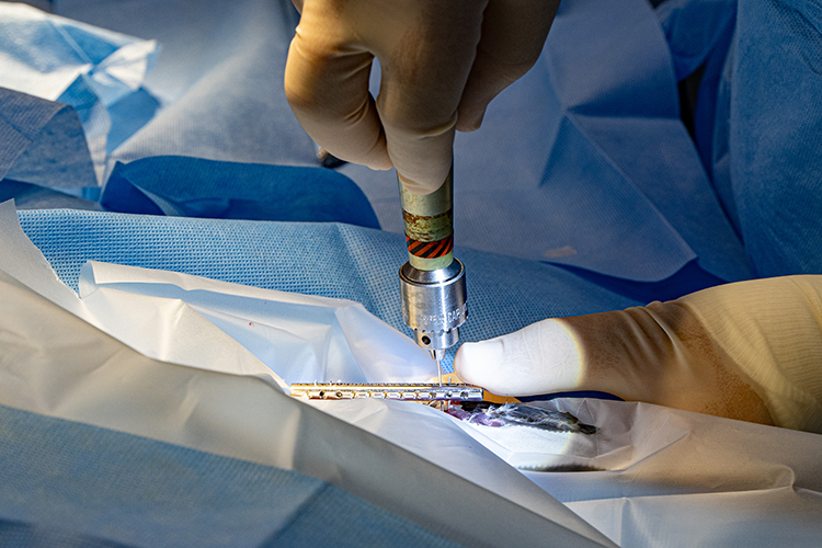 The fixator is attached to the wing with pins. The surgeon, wearing rubber gloves, is putting in the pins with a special device.