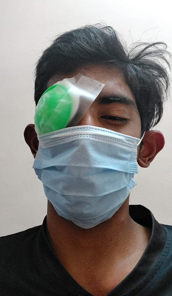 Vihaan with a bandage over his right eye and wearing a face mask