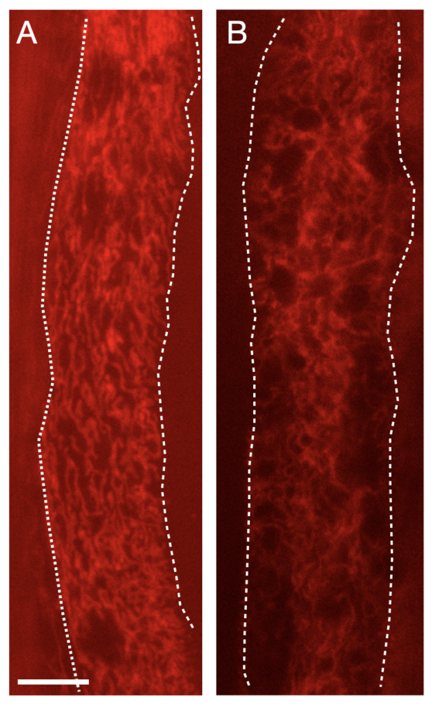 white dotted lines outline the midsections of two nematodes stained red, one of them showing holes in the redness