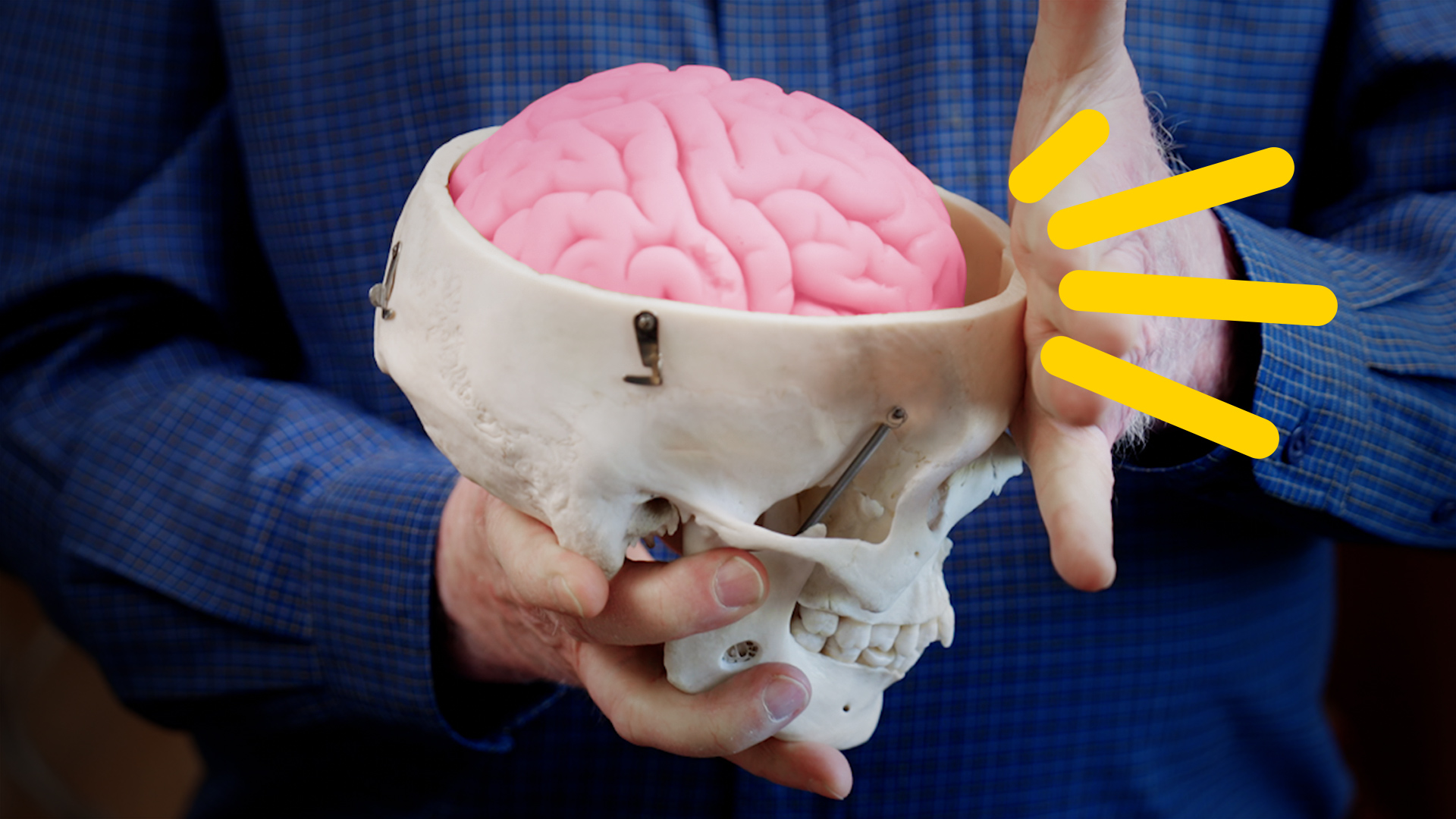 a pink brain sits inside a topless model of a human skull, with yellow bars indicating where a hand is slapping it