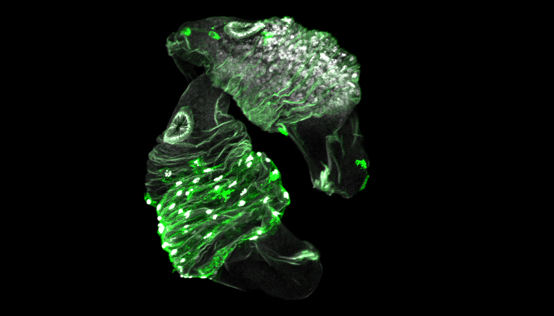 two translucent blobs against a black background, with green strands wrapped around them