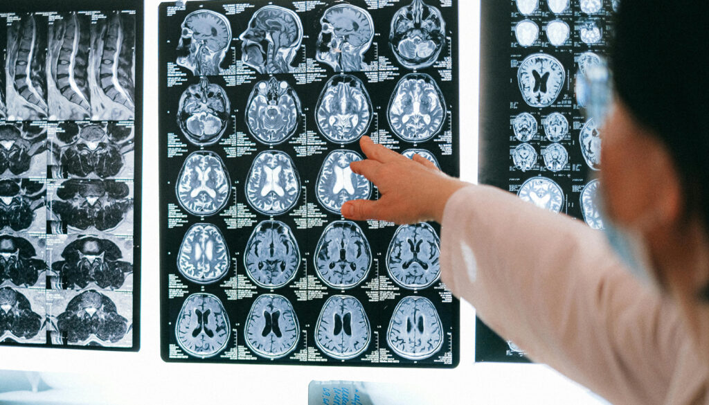a woman in a white coat is pointing at black and white brain scans mounted on a light box