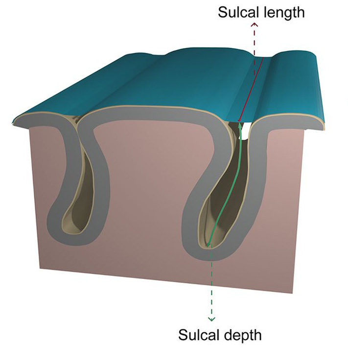 cross sectional drawing of the sulcus of a brain, showing the deep groove