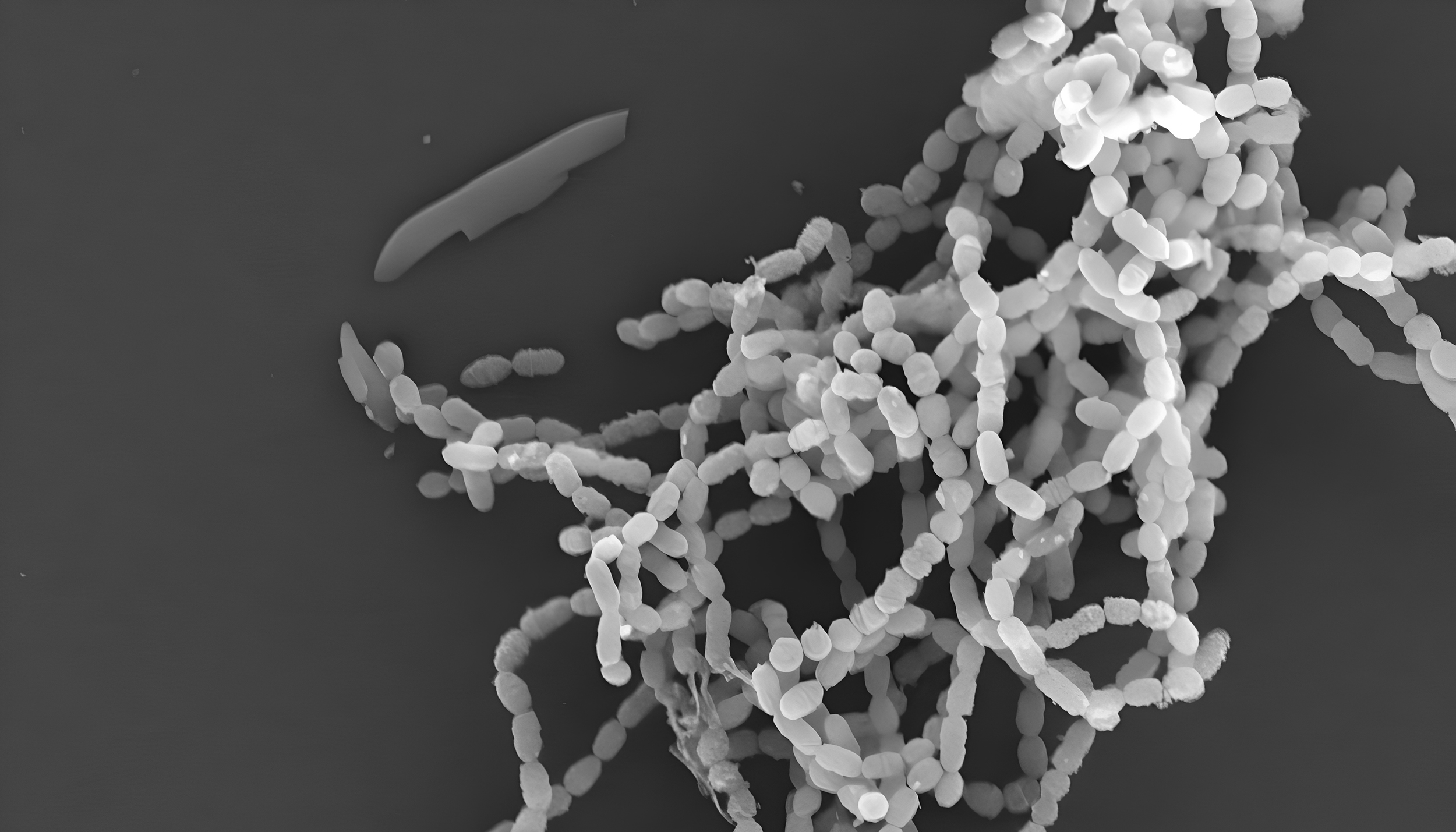 black and white image of tangled strands of pearl-like white blobs
