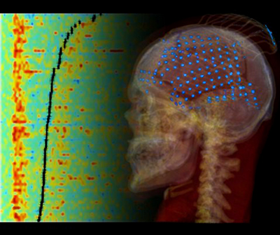 Illustration of ctivity in the auditory cortex