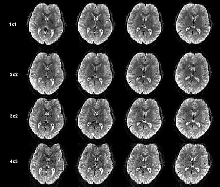 fMRI brain scans showing new acceleration technique