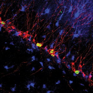 Activated nerve cells in the hippocampus.