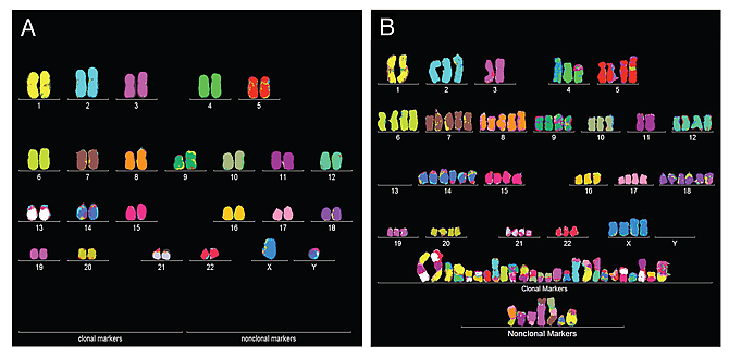 Karyograms of normal and cancerous cells.