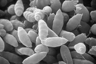 scanning electron micrograph of cypress pathogen