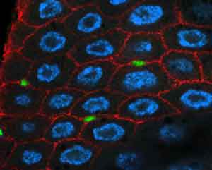 Midgut cells of fruit fly, with stem cells labeled in green.