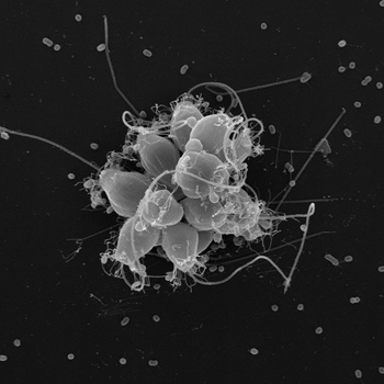 A cluster of colony-forming choanoflagellates.