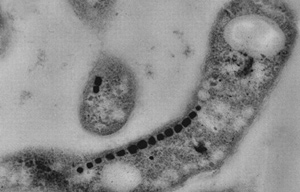 magnetotactic bacteria